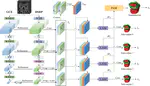 ALA-Net: Adaptive Lesion-Aware Attention Network for 3D Colorectal Tumor Segmentation